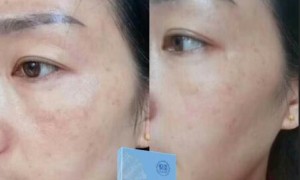 明星抗皱紧致用什么方法？紧致抗皱首选悦蕾冰泉焕颜蚕丝面膜