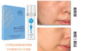 女人抗皱紧肤的护肤方法有哪些？补水抗皱推荐悦蕾冰泉面膜