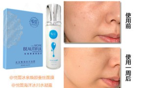悦蕾面膜+悦蕾水凝露：完美拯救熬夜受损肌肤