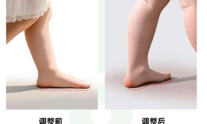芯迈儿童步态调整与纠正解决方案，应对国内儿童足部问题挑战